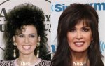Has Marie Osmond Gotten Plastic Surgery? Our Experts Weigh in!