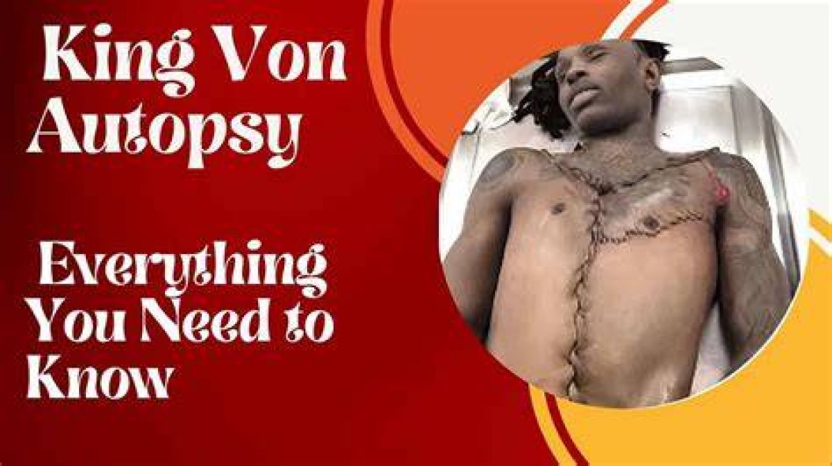 Intriguing Details About King Vin's Autopsy