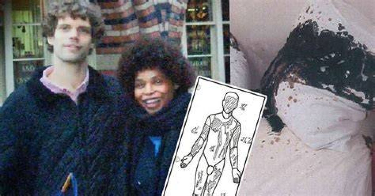 Mark Van Dongen Face Before and After Pictures: Paralysed Acid Attack Victim Committed Assisted Suicide Death
