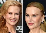 Nicole Kidman: the Plastic Evolution of a Timeless Star in 2024