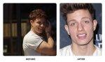Transformative Smile: Matt Rife Teeth Before and After
