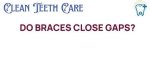 Unveiling the Truth About Teeth Gaps