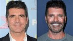 What's the Truth About Simon Cowell's Mysterious Eye Condition?